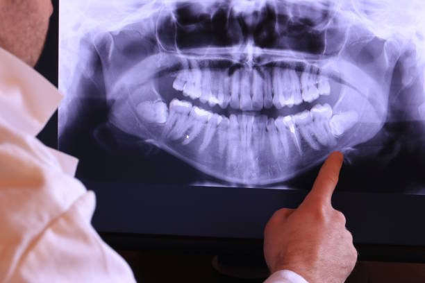 Best Holiday Emergency Dentist in Marienville, PA