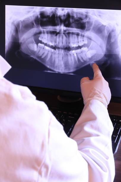 Best Emergency Root Canal Treatment in Marienville, PA