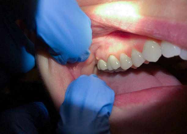 Best Pediatric Emergency Dentist in Marienville, PA
